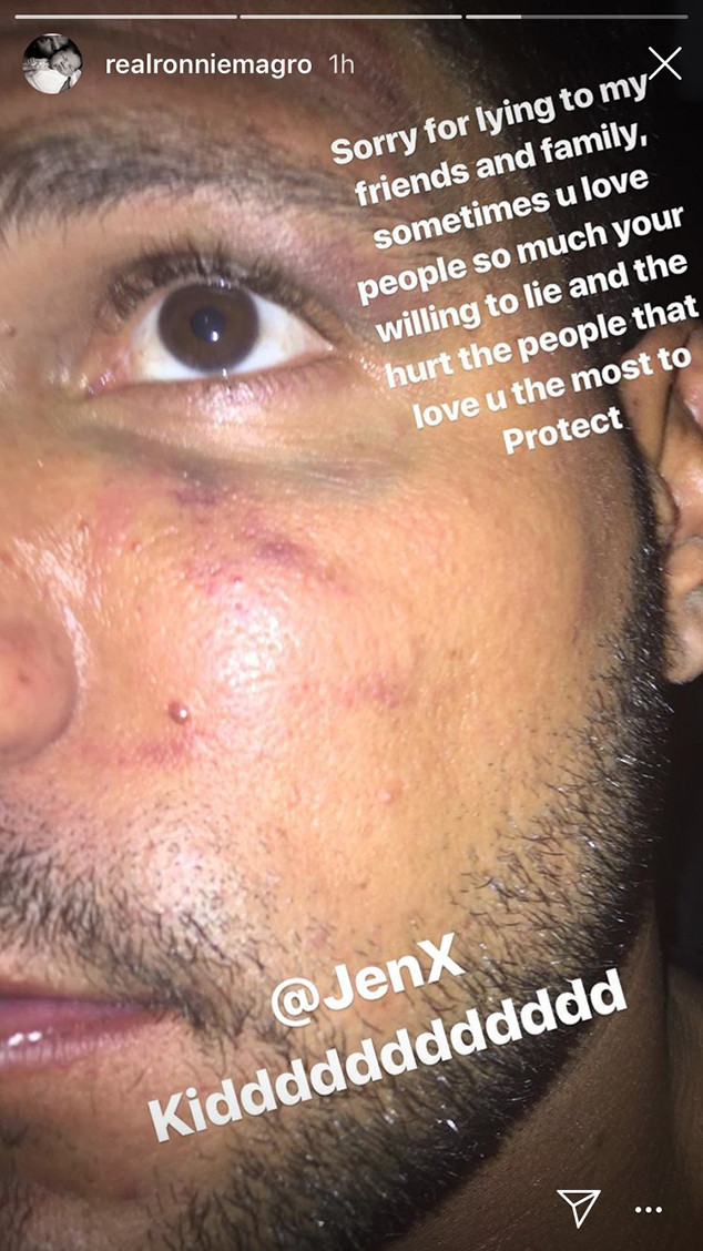 Jersey Shore S Ronnie Ortiz Magro Claims Jen Harley Gave Him A